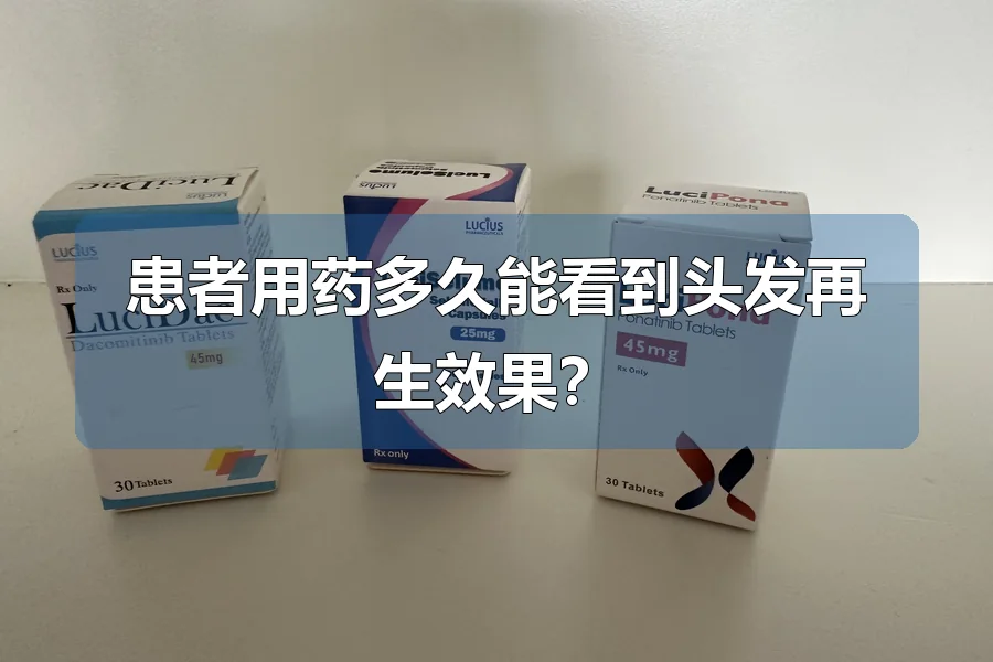 患者用药多久能看到头发再生效果?
