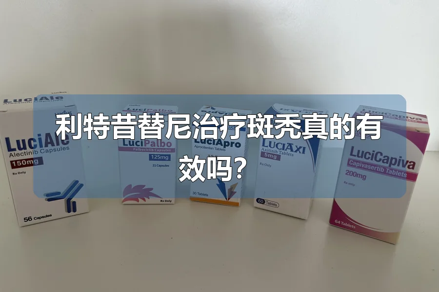 利特昔替尼治疗斑秃真的有效吗?